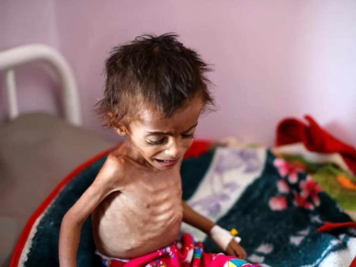Over 14 million people could die from US foreign aid cuts – study