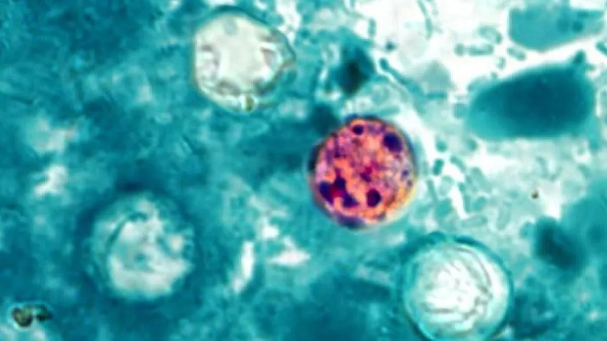 Cyclosporiasis Cases Rise Nationally, California Officials Advise Precautions