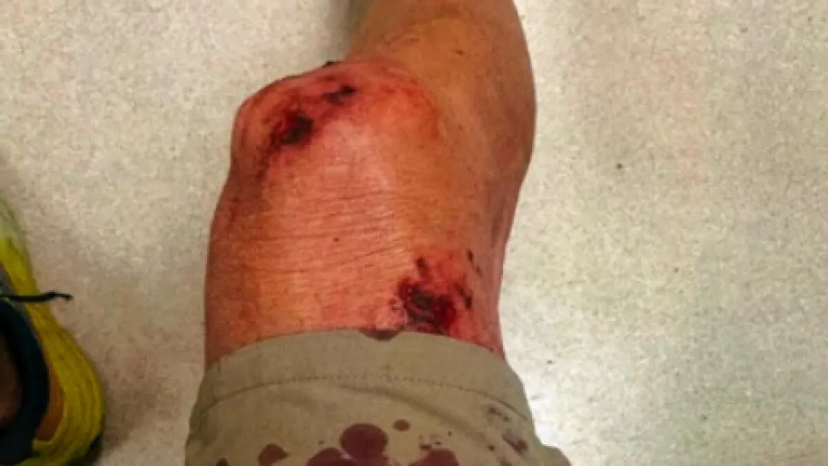 Dog Accused of Four Attacks Euthanized After Lengthy Legal Battle
