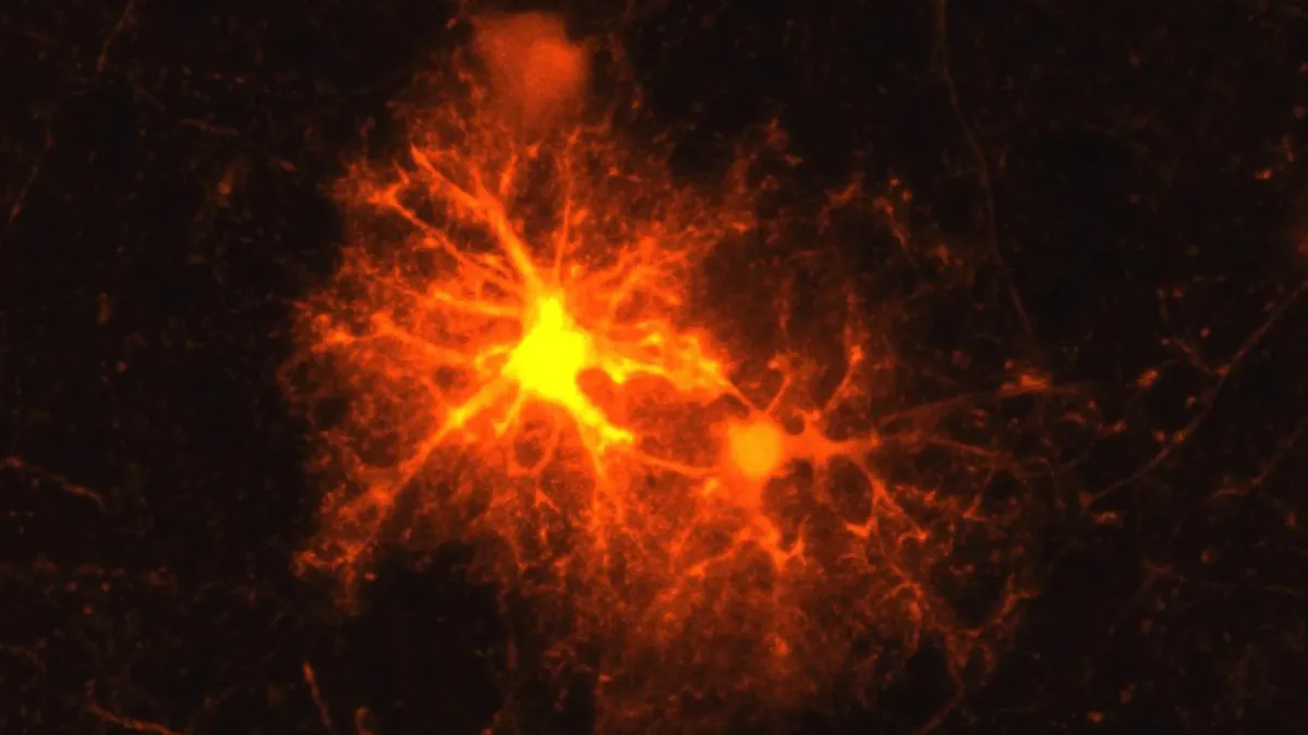 Brain's Stress Hormone Key to Self-Repair and Development